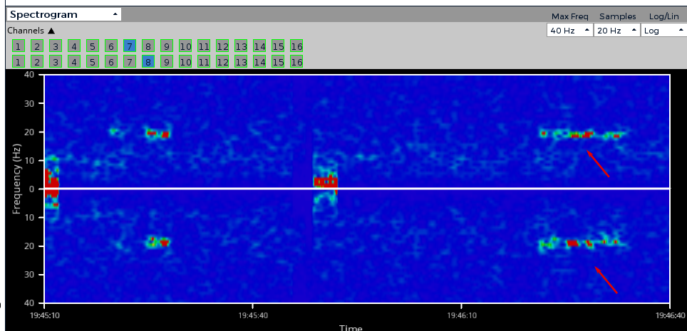 Frequency graph showing alpha waves